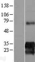 SUSD6 / KIAA0247 Protein (Over-Expression Lysate Myc-DDK (Flag))