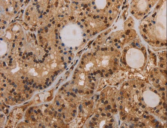 KCNN4 / KCa3.1 Antibody