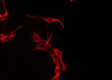 UEVLD Antibody