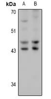 Polyclonal Rabbit anti-Human HSD17B2 Antibody (WB)