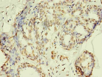 Monoclonal Mouse anti-Human R1 / RRM1 Antibody (clone 3D6H5, IHC)