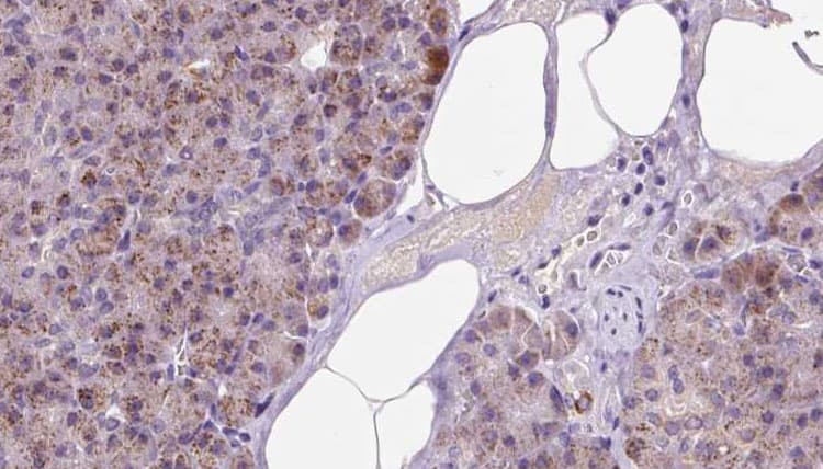 Polyclonal Rabbit anti-Human ETFA Antibody (IHC, IF, WB)