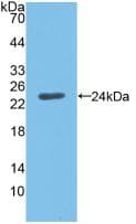 ANGPTL8 / Betatrophin Antibody (aa16-198)