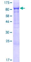 Human PHF21B Protein (Recombinant GST)