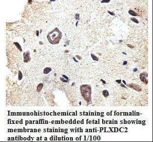 PLXDC2 Antibody (aa260-435)