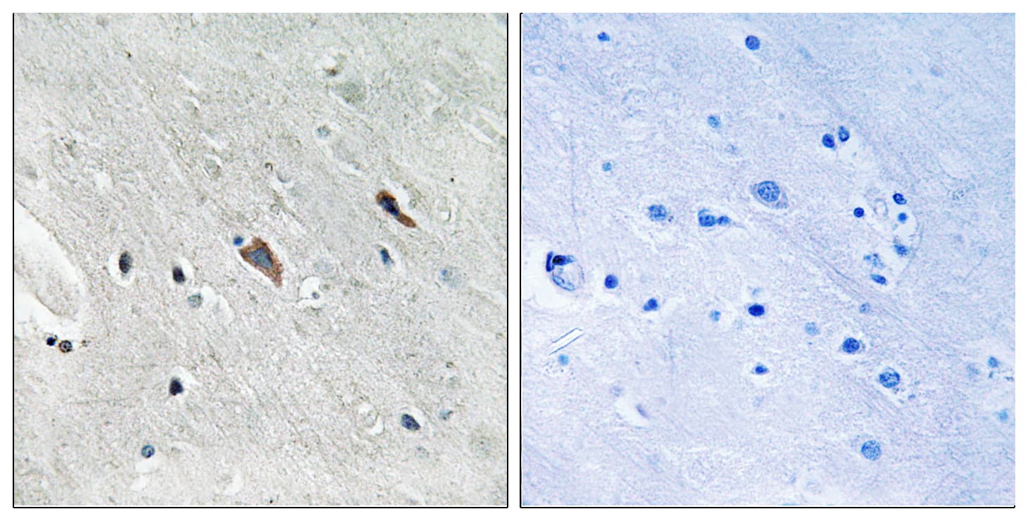 Polyclonal Rabbit anti-Human GAB2 Antibody (phospho-Tyr643, IHC, WB)