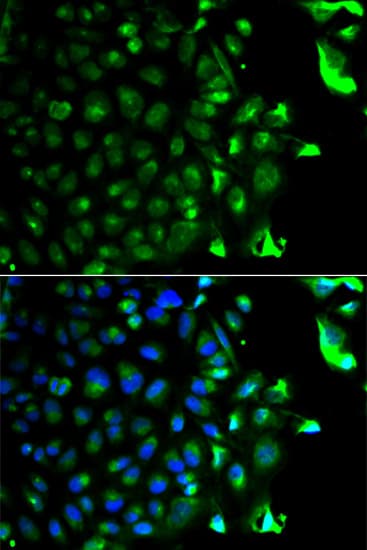 PathPlus™ RAB5A / RAB5 Antibody
