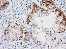 BAIAP2 / IRSP53 Antibody (clone OTI 1D9)