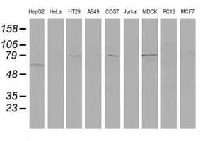 VCAM1 / CD106 Antibody (clone OTI4A10)