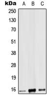 Polyclonal Rabbit anti-Human IL9 Antibody (Internal, WB)