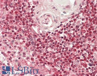 IHC-plus™ RBM27 Antibody (aa700-750)