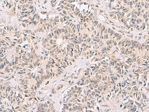 RNF13 Antibody