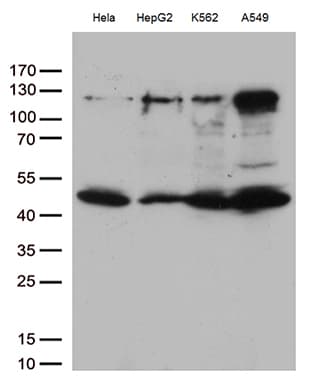 IKBKG / NEMO / IKK Gamma Antibody (clone OTI3C3, Carrier-free)