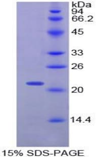 Rat CENPE Protein (Recombinant His-T7)
