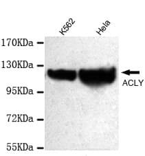 ACLY / ATP Citrate Lyase Antibody (C-Terminus)