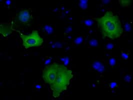 BTK Antibody (clone OTI1H7)