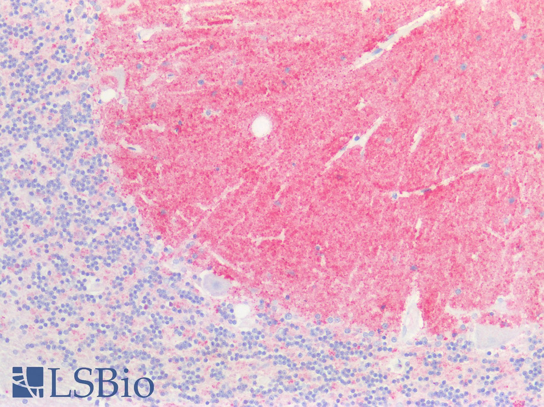 PathPlus™ SNCA / Alpha-Synuclein Antibody (N-Terminus)