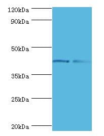 GTF2H2C Antibody (aa1-260)