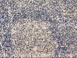 TBCEL / E-Like Antibody (clone OTI2A9)