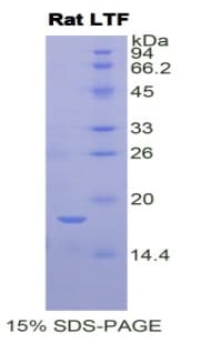 Rat LF / LTF / Lactoferrin Protein (Recombinant His)