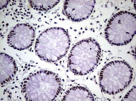 NBN / Nibrin Antibody (clone OTI6E11)