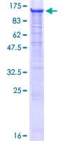 Human FBXO30 Protein (Recombinant GST)