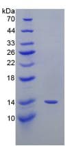Mouse PTGS2 / COX2 / COX-2 Protein (Recombinant His)