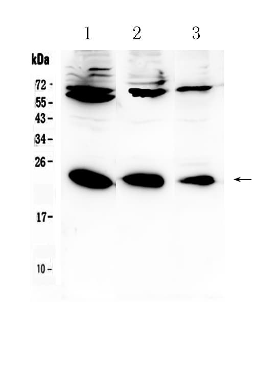 Polyclonal Rabbit anti-Human IL2 Antibody (WB)