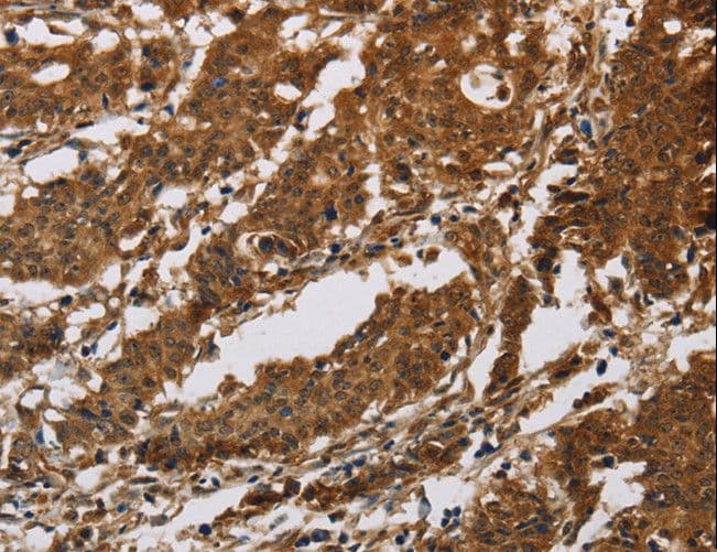 IHC-plus™ IL17RB Antibody