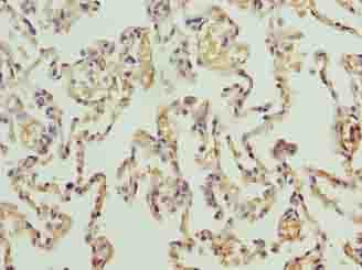 PRDM14 Antibody