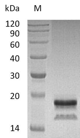 Human IL17A Protein (Recombinant 6His, C-terminus)