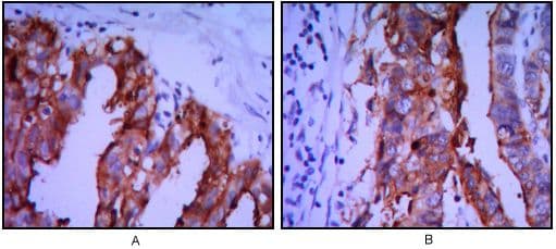 Monoclonal Mouse anti-Human PLAP / Alkaline Phosphatase Antibody (clone 300000, IHC, WB)