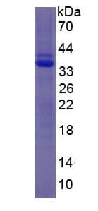 Human PLG / Plasmin / Plasminogen Protein (Recombinant His, N-Terminal)
