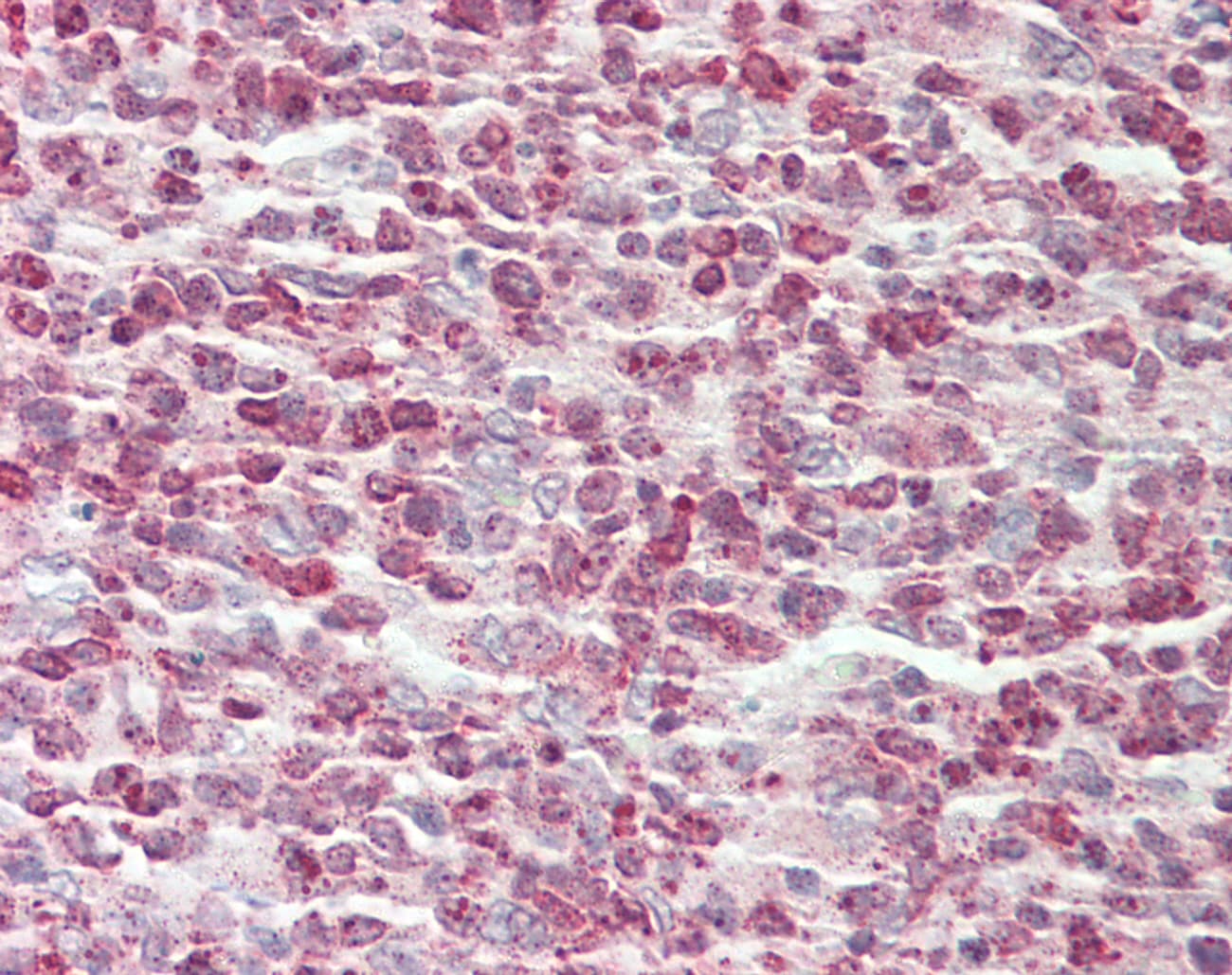 CBFA2T2 / MTGR1 Antibody (C-Terminus)