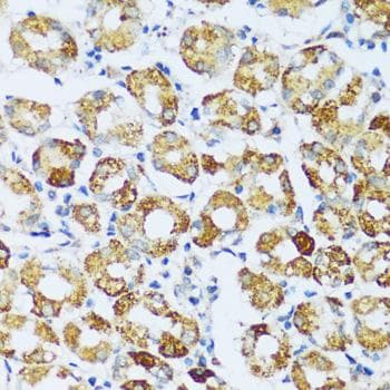 Polyclonal Rabbit anti-Human C1QG / Complement C1QC Antibody (IHC)