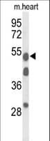 A1BG Antibody (aa225-254)