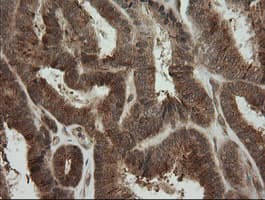 PIK3CG / PI3K Gamma Antibody (clone OTI1A9)