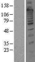 Treacle / TCOF1 Protein (Over-Expression Lysate Myc-DDK (Flag))