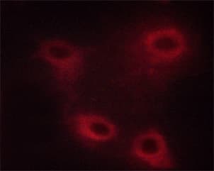 MAP3K8 / TPL2 Antibody (phospho-Thr290)