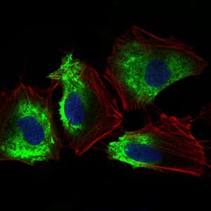 IHC-plus™ Monoclonal Mouse anti-Human THY1 / CD90 Antibody (clone 7E1B11, aa17-132, IHC, IF, WB)
