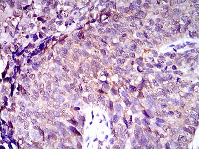 Monoclonal Mouse anti-Human ABCC4 / MRP4 Antibody (clone 2D2A9, aa631-692, IHC, WB)