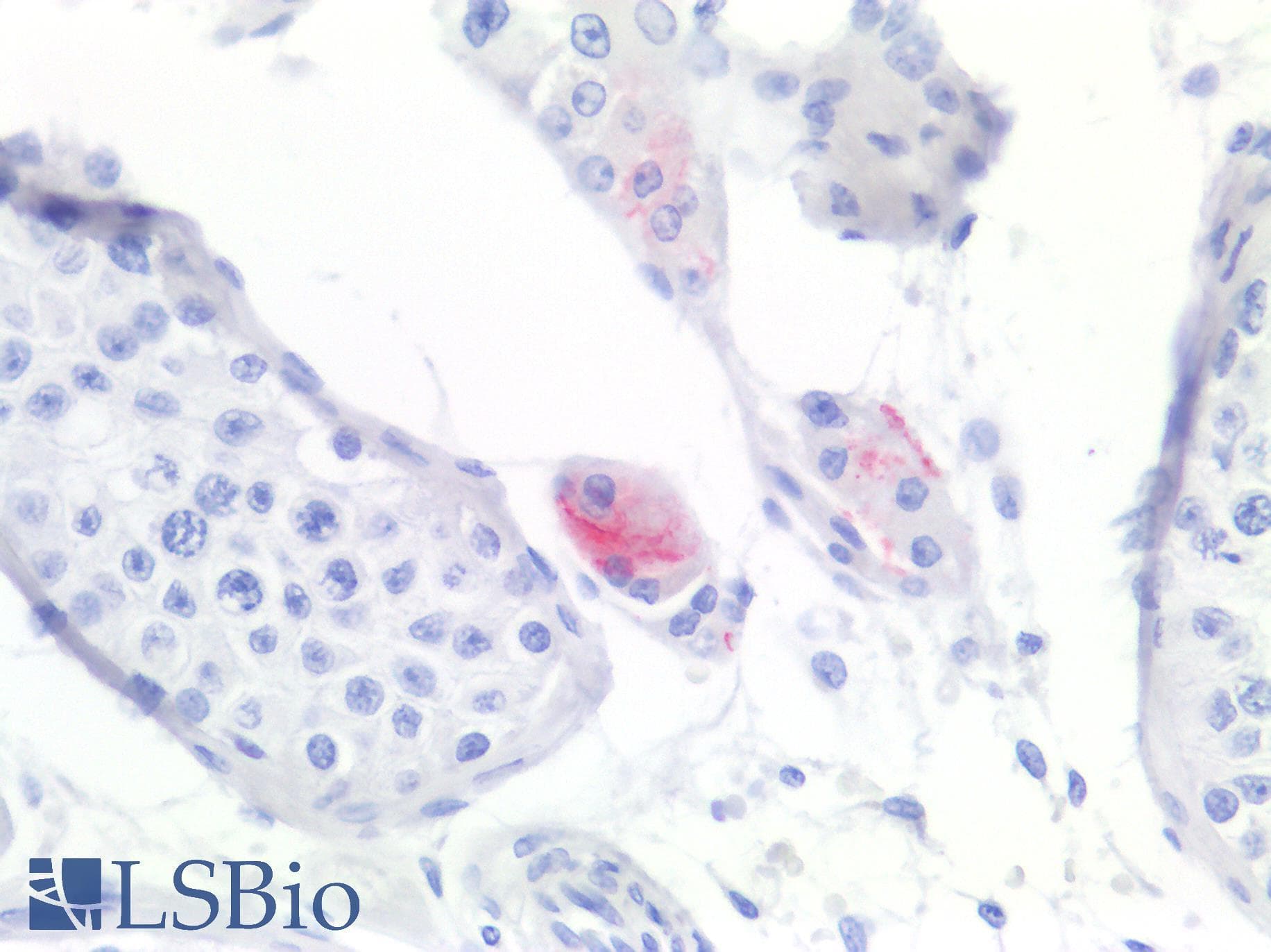 IHC-plus™ SCARB1 / SR-BI Antibody (clone OTI1F3)