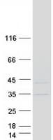 Human SKAP / HSD11 Protein (Recombinant Myc-DDK (Flag))