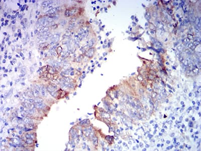 Monoclonal Mouse anti-Human GRIA2 / GLUR2 Antibody (clone 7A7A3, IHC, WB)