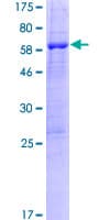 Human PPIL6 Protein (Recombinant GST)