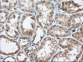 TTC32 Antibody (clone OTI3C2)