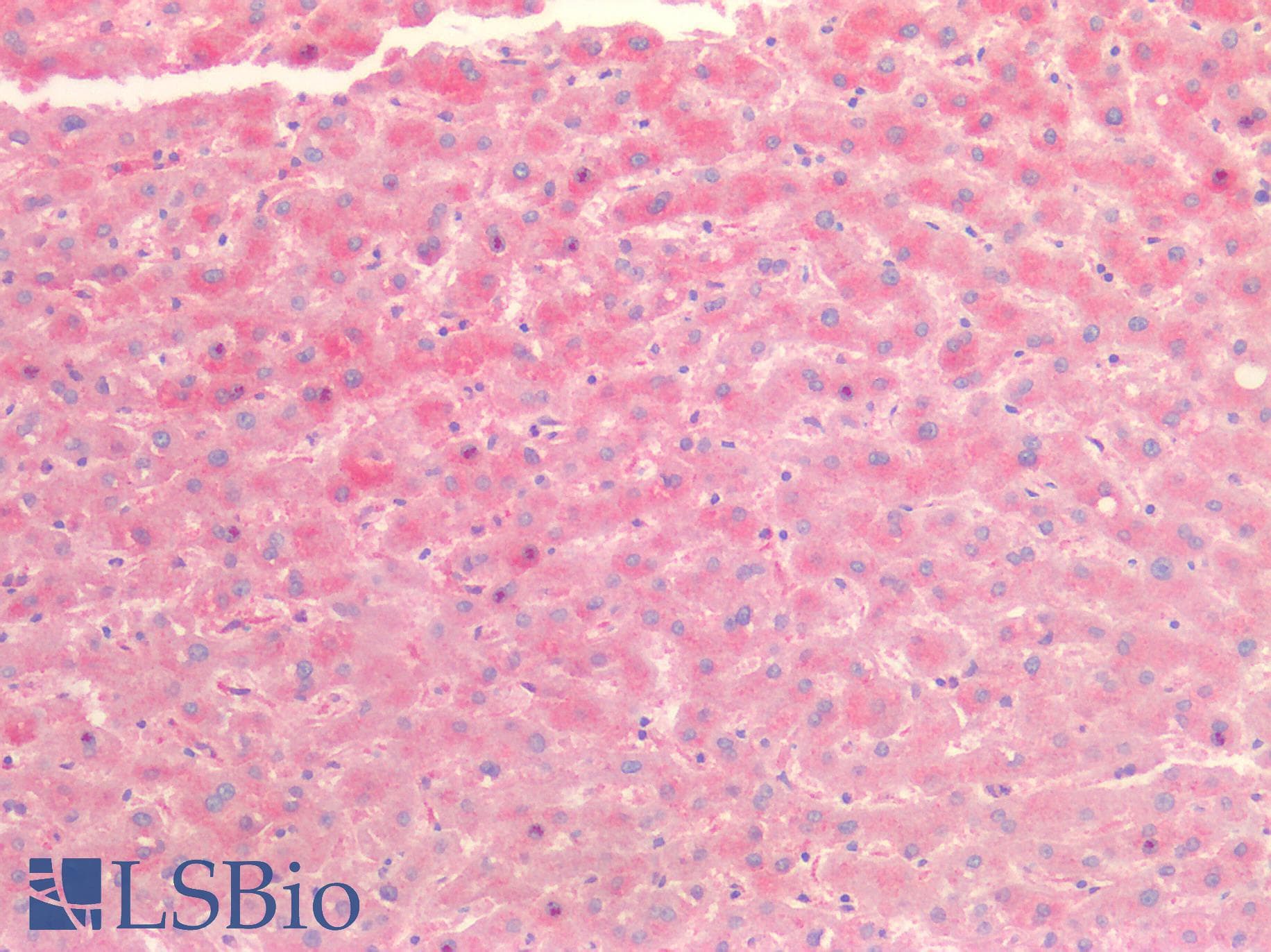 IHC-plus™ TTR / Transthyretin Antibody