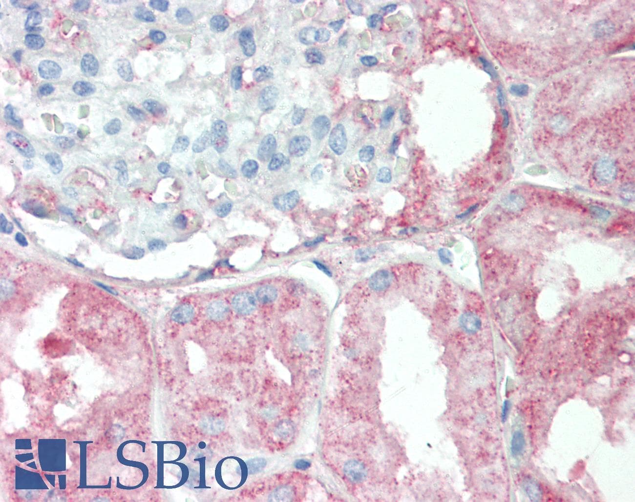 IHC-plus™ Polyclonal Rabbit anti-Human RPS6KC1 Antibody (aa231-280, IHC, IF, WB)