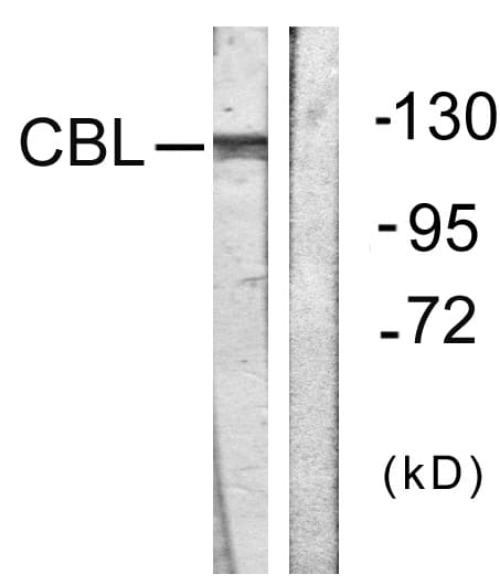 c-CBL Antibody (aa640-689)