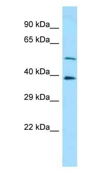 CAP2 Antibody (aa242-291)
